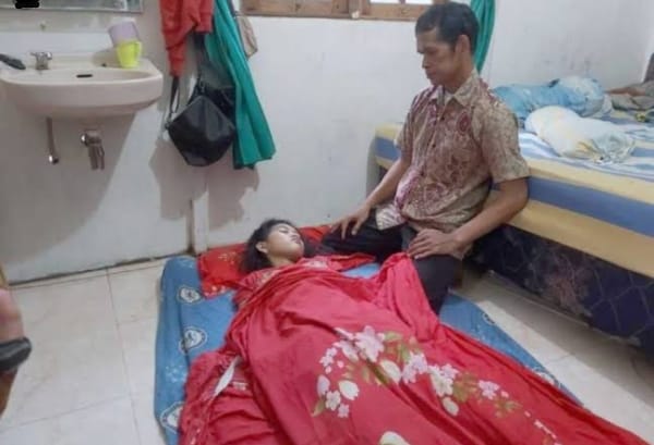 Viral, Echa Si Putri Tidur Asal Banjarmasin Akhirnya Bangun Usai Sembilan Hari Tertidur