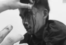 Seorang kurir Shopee Express saat menjalani perawatan medis setelah diduga menjadi korban pengeroyokan saat mengantarkan paket di wilayah Pasirkuda, Kabupaten Cianjur. Foto: Istimewa